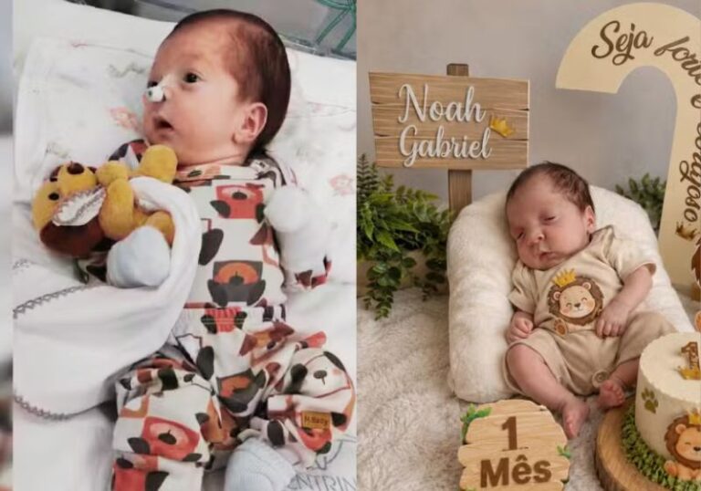 Bebê Noah, dado como morto, deixa a UTI, respira sem aparelhos e já recebe visitas